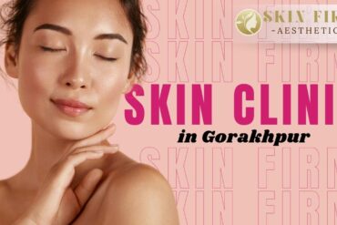 Skin Clinic in Gorakhpur