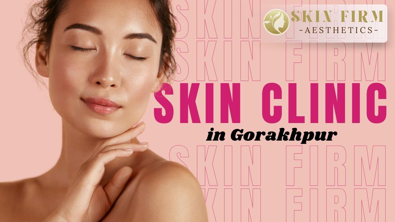Skin Clinic in Gorakhpur